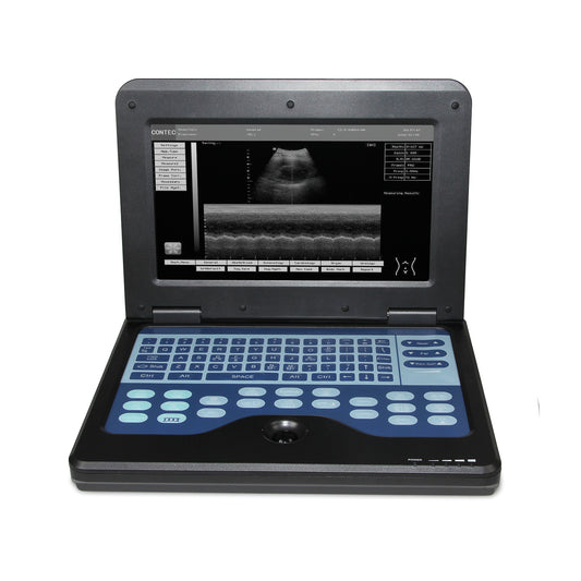 Portable Ultrasound Scanner Laptop Digital Diagnostic Machine 3.5 Convex Probe - MEDIJIX