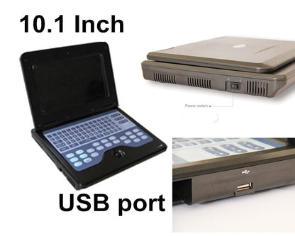 Portable Ultrasound Scanner Laptop Digital Diagnostic Machine 3.5 Convex Probe - MEDIJIX