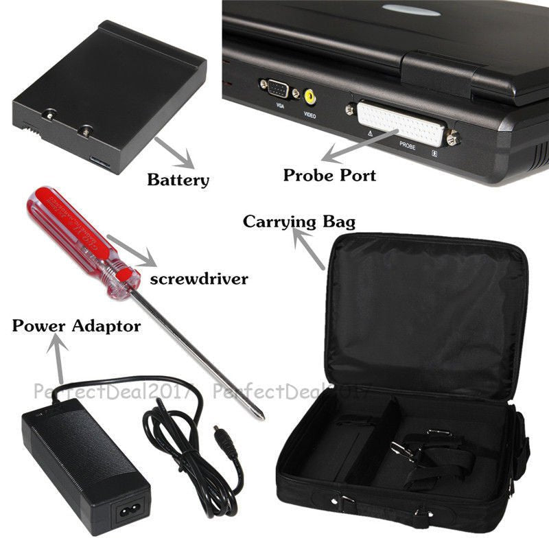 Portable Ultrasound Scanner Laptop Digital Diagnostic Machine 3.5 Convex Probe - MEDIJIX