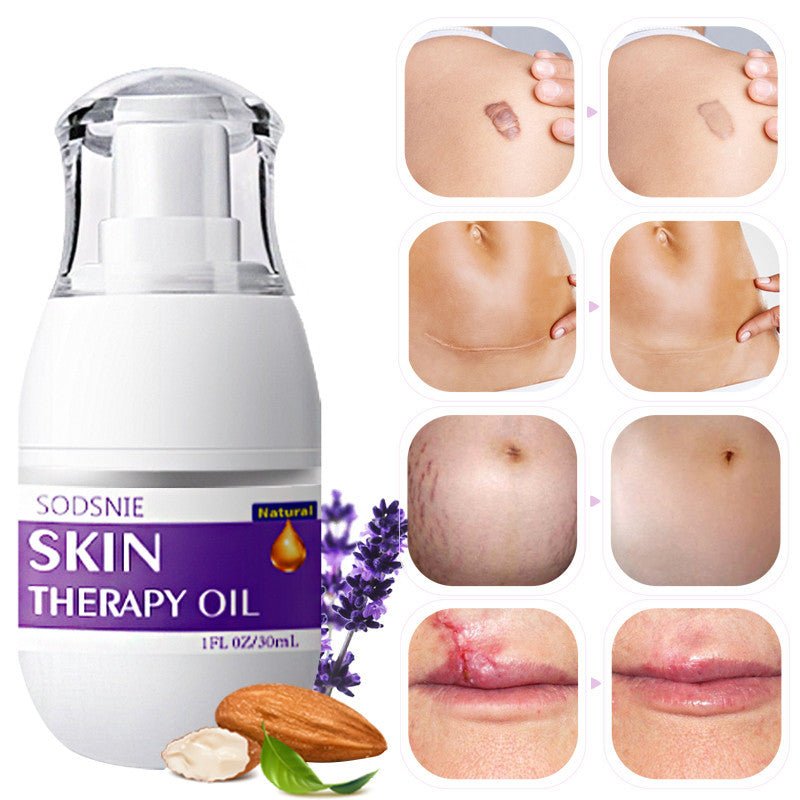 Skin Treatment Oil Remove Puncture Cellulite Stretch Mark Repair Body Care 30ml - MEDIJIX